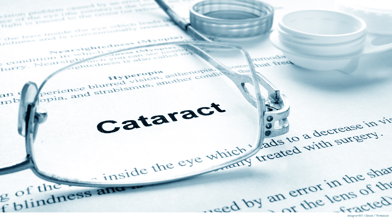 Does Tricare Cover Laser Cataract Surgery All